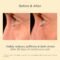 ISDIN Isdinceutics K-Ox Eyes